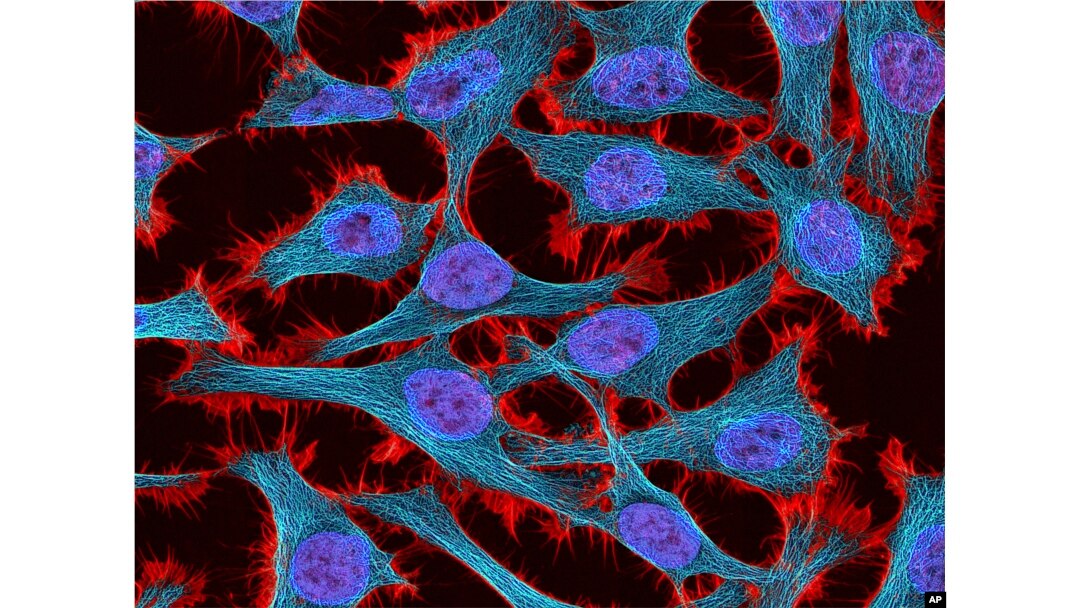 FILE - This undated microscope image made available by the National Center for Microscopy and Imaging Research shows HeLa cells.