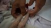 FILE - The stepmother of Mohammed, 4-month-old, who is malnourished, holds his legs in the Indira Gandhi hospital in Kabul, Afghanistan, Nov. 8, 2021.