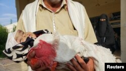 یک پدر یمنی در حال انتقال دختر خردسال‌اش که در اثر حمله‌ای میزایل شورشیان حوثی زخمی شده است
