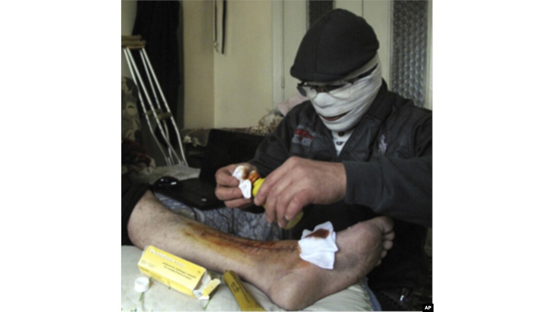 An injured man gets treated in a Damascus neighborhood, Syria, Tuesday, April 3, 2012.