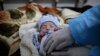 FILE - A doctor checks two-month-old Mujahed Ali, suffering from a cholera infection, at Al-Sabeen hospital, in Sanaa, Yemen, Mar. 30, 2019. 