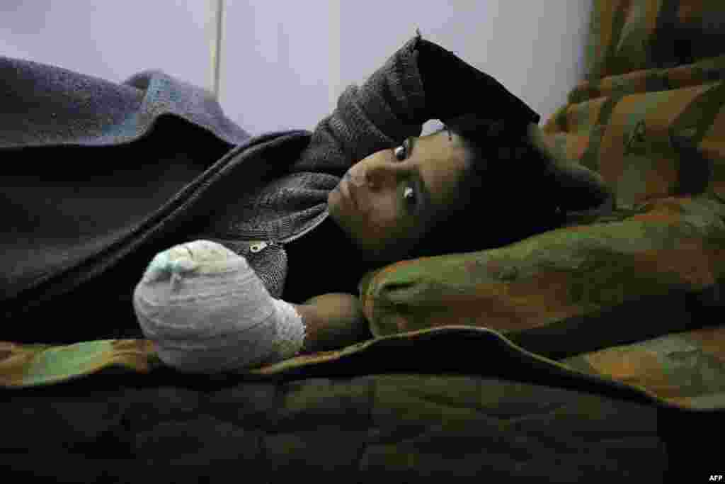 Syrian child Khaled al-Ghorani lies at a clinic after he had his hand amputated in Kafar Batna in the Syrian rebel enclave of Eastern Ghouta, following reported air strikes by Syrian government forces.
