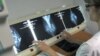 FILE - Doctors pump cancer-fighting medicine directly into a breast tumor.