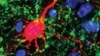 This enhanced image of a mouse brain shows fibers (green) that connect the thalamus, the midbrain’s switchboard for sensory information to neurons (red) in the auditory cortex. (Credit: Emily Petrus/Amal Isaiah)