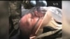 Польовий госпіталь із США кілька місяців не відправляли на передову АТО