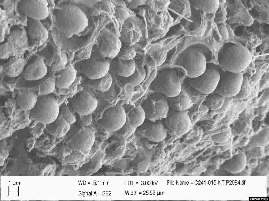 Scientists suspect that the pit forming bacteria may play a role in degrading plastics. (Credit: E. Zettler, SEA Education Association)