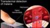 A possible rapid, non-invasive test for malaria infection detects tiny vapor nanobubbles produced by the malaria parasite when it is zapped by a short laser pulse. (Rice University)