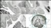 Brain Imaging Comes to Children in Africa 