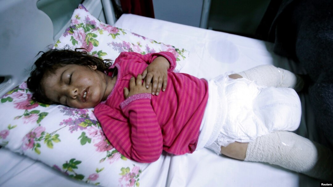 Dima Nadm Hamid, 3, is being treated for possible exposure to chemical weapons agents in a hospital west of Mosul, Iraq, March 4, 2017. 